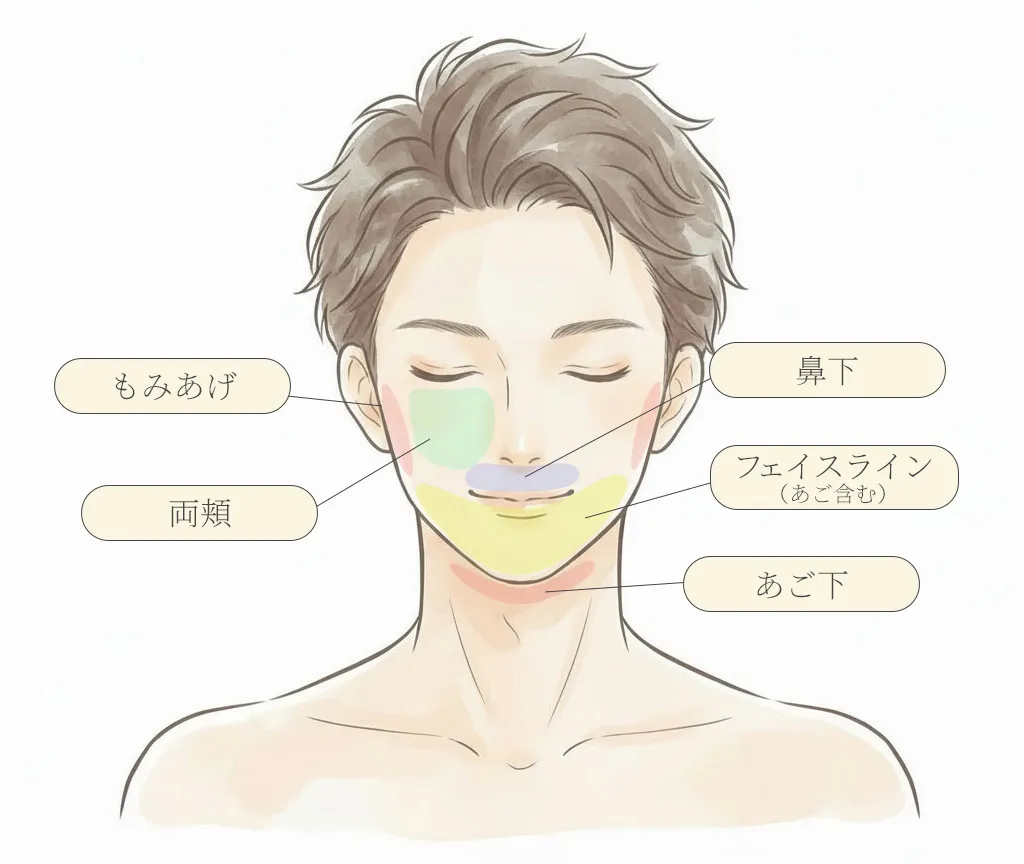 男性医療脱毛(顔)部位