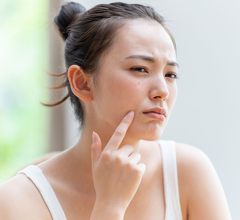 糸リフト（たるみ、コケ、ほうれい線等の改善）